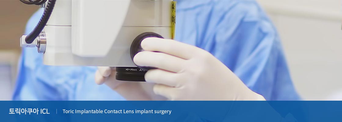 토릭아쿠아 Toric Implantable Contact Lens implant surgery